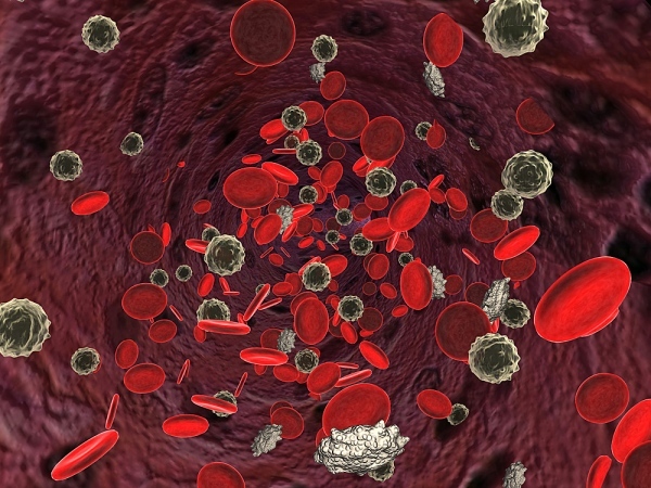 Болезни системы крови. B12 дефицитная анемия