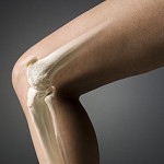 Причины развития артроза коленного сустава. Проведение коррекции