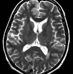 Фото головного мозга человека