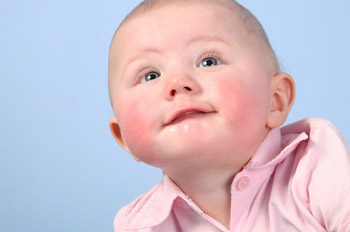 Опасна ли аллергия на коже у детей?