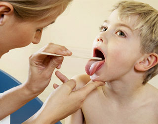 Герпесная ангина у детей: лечение