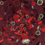 Болезни системы крови. B12 дефицитная анемия