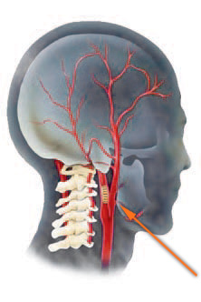Какие функции выполняет сонная артерия на шее?
