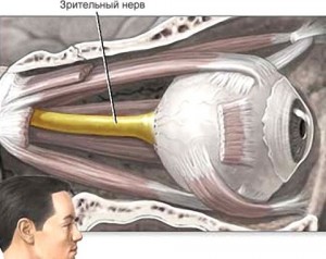 Частичная атрофия зрительного нерва: