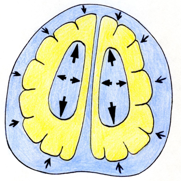 Что нужно знать о наружной гидроцефалии головного мозга?