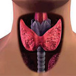Группа риска гипотиреоза щитовидной железы