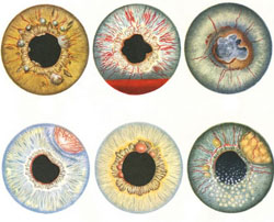 виды болезни глаз