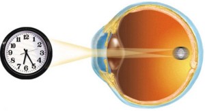 Нарушение преломляющих свойств оптической среды глаза